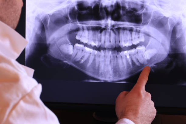 Best After-Hours Emergency Dentist in Cedar Creek, TX