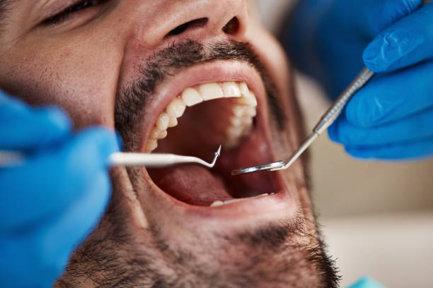 Best Walk-In Emergency Dentist in Cedar Creek, TX
